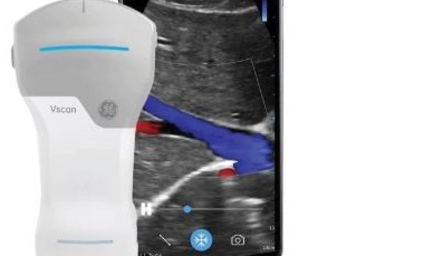 Ecografo Palmare Vscan Air CL Probe GE | Fisiosport Italia